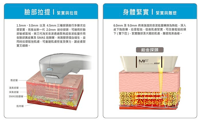 【醫美】2024 鳳凰電波 & 海芙音波 初體驗 ｜濰視美學